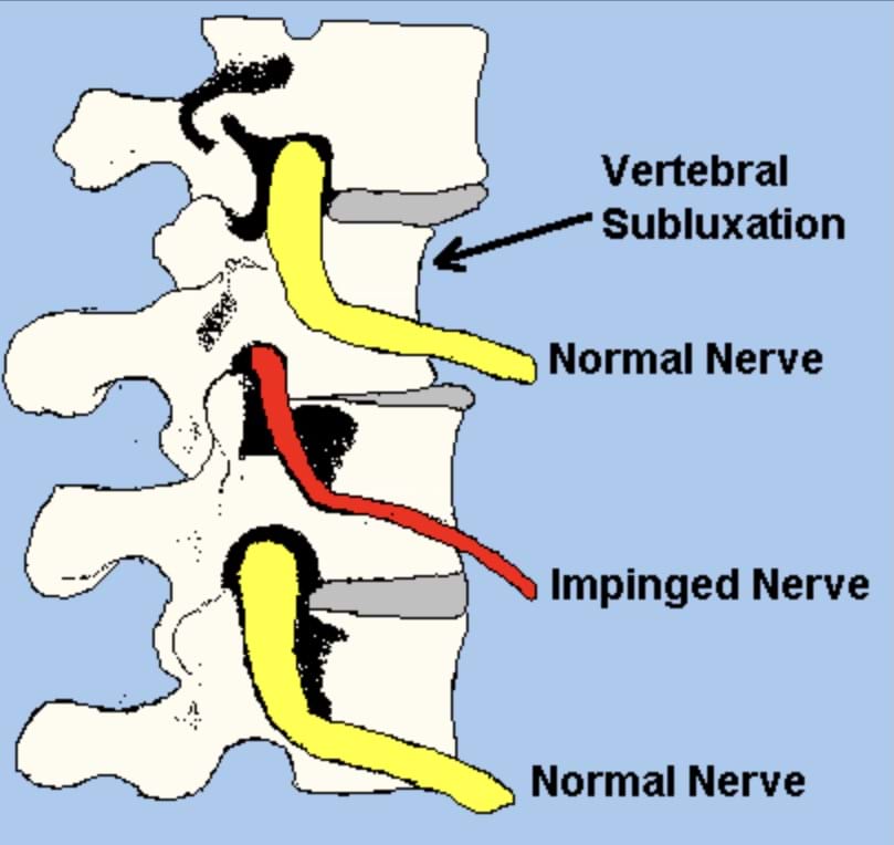 What is an adjustment?| How do chiropractors help with pain?